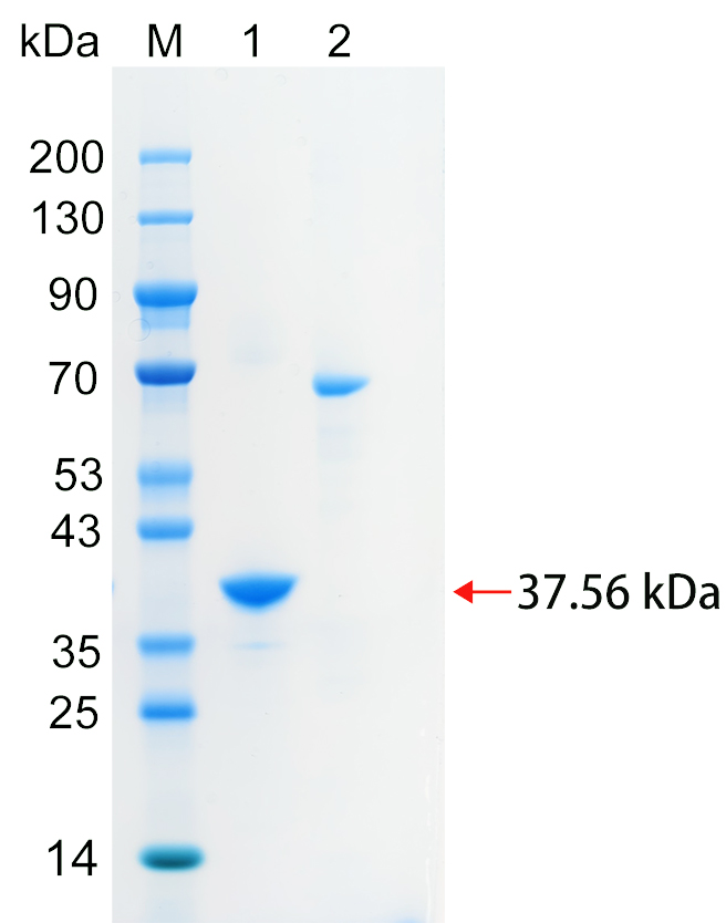 Recombinant NCAN protein (His tag) SDS-PAGE