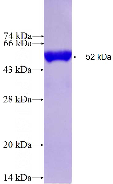 Recombinant Human MYCBP2 SDS-PAGE
