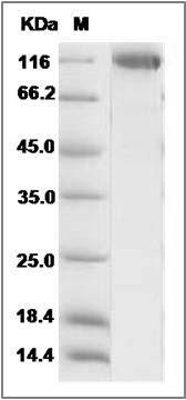Rat ENPEP / Aminopeptidase A Protein (aa 41-945, His Tag) SDS-PAGE