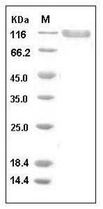 Human PSGL-1 / CD162 Protein (His & Fc Tag) SDS-PAGE