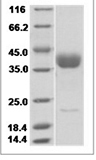 Mouse CD33/Siglec-3 Protein 15524