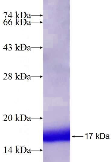 Recombinant Human ESRRB SDS-PAGE
