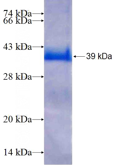 Recombinant Human ELMOD3 SDS-PAGE