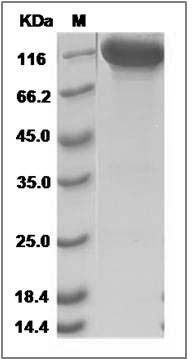 Human NCAM2 / Neural cell adhesion molecule 2 Protein (Fc Tag) SDS-PAGE