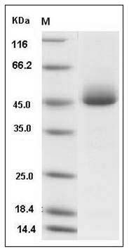 Mouse Prostatic Acid Phosphatase / ACPP Protein (His Tag) SDS-PAGE