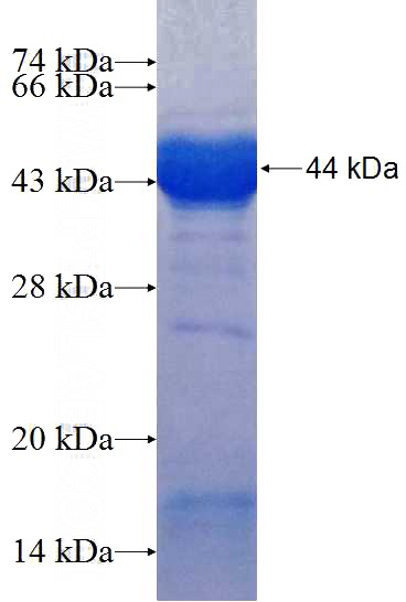 Recombinant Human IFT140 SDS-PAGE