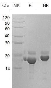 Human CTGF/CCN2/HCS24/IGFBP8 recombinant protein