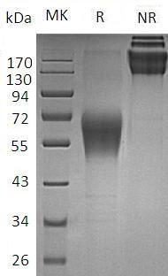 Human TNFRSF10D/DCR2/TRAILR4 (Fc tag) recombinant protein