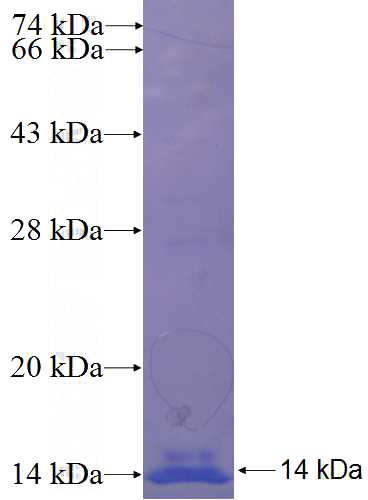Recombinant Human FAM120C SDS-PAGE