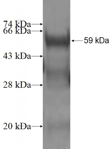 Recombinant Human ETV7 SDS-PAGE