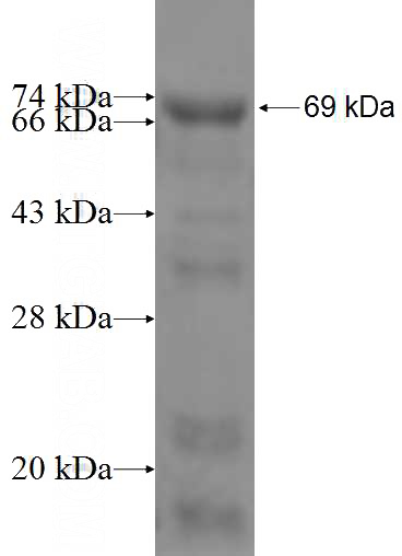 Recombinant Human FEN1 SDS-PAGE
