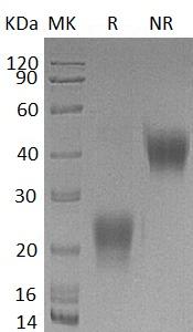 Human BST2 (His tag) recombinant protein