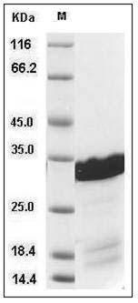 Human BCL2L1 / Bcl-XL Protein (His Tag) SDS-PAGE