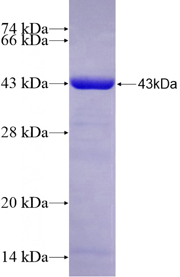 Recombinant Human CHN2 SDS-PAGE
