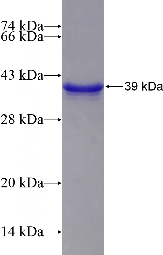 Recombinant Human RPIA SDS-PAGE