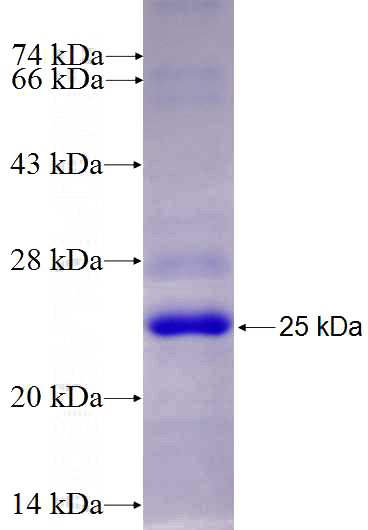 Recombinant Human KIBRA SDS-PAGE