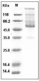 Human CD70 / CD27L / TNFSF7 Protein (Fc Tag) SDS-PAGE
