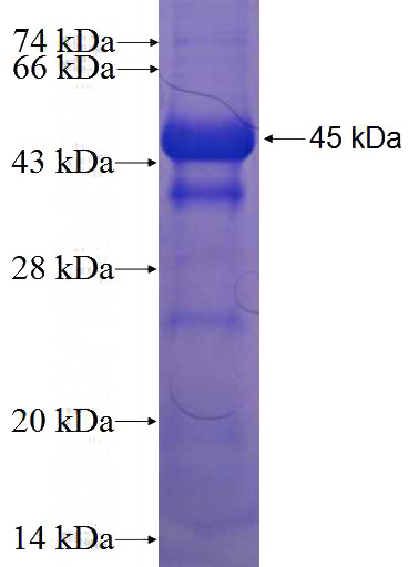 Recombinant Human ZNF438 SDS-PAGE