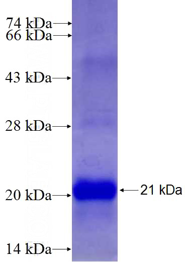 Recombinant Human TNFRSF17 SDS-PAGE