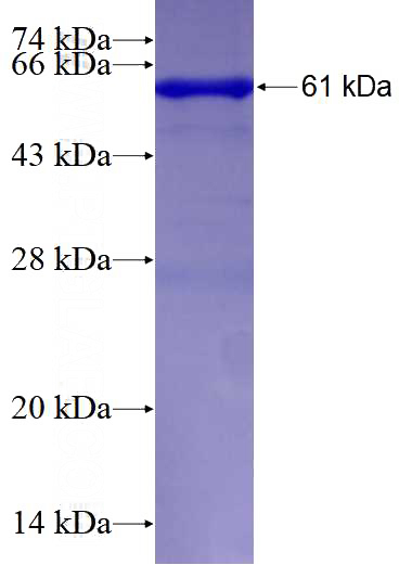 Recombinant Human GAS2 SDS-PAGE