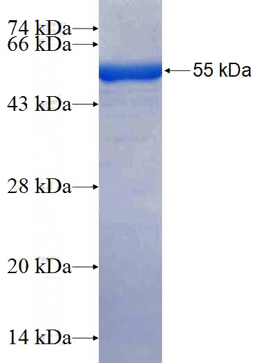 Recombinant Human LRRC59 SDS-PAGE