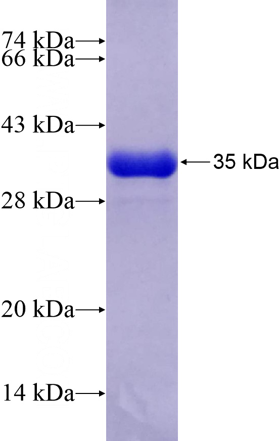Recombinant Human PECR SDS-PAGE
