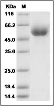 Human SMPDL3A Protein (His Tag) SDS-PAGE