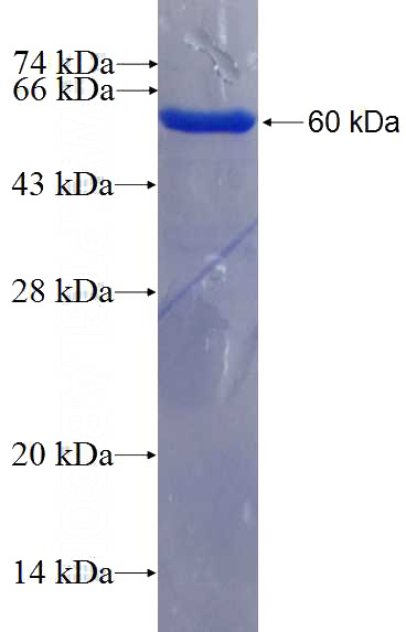 Recombinant Human YTHDC2 SDS-PAGE