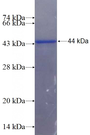 Recombinant Human ZDHHC5 SDS-PAGE