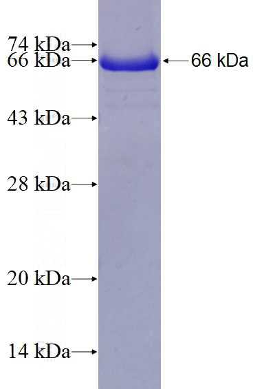 Recombinant Human UBE2Q2 SDS-PAGE
