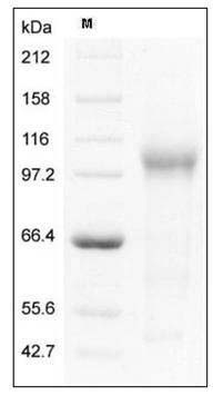 Mouse TGFBR3 / Betaglycan Protein (His Tag) SDS-PAGE