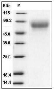 Human CD155 / PVR Protein (His Tag) SDS-PAGE