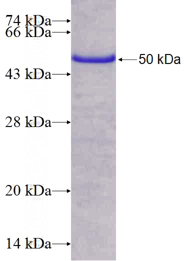 Recombinant Human RAB5A SDS-PAGE