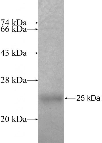 Recombinant Human SNX24 SDS-PAGE