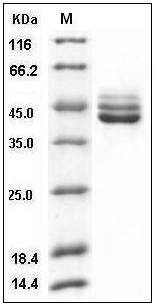 Human IL12B / P40 Protein (His Tag) SDS-PAGE