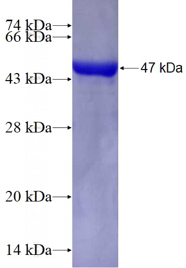 Recombinant Human BBS3 SDS-PAGE