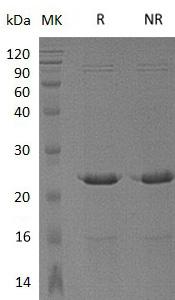 Human ANGPTL8/C19orf80/RIFL (His tag) recombinant protein