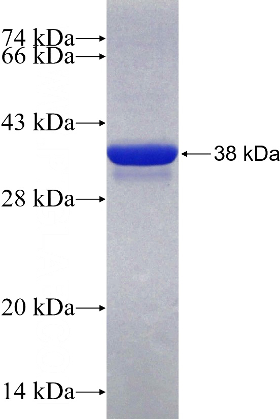 Human PVALB Recombinant protein (GST tag)