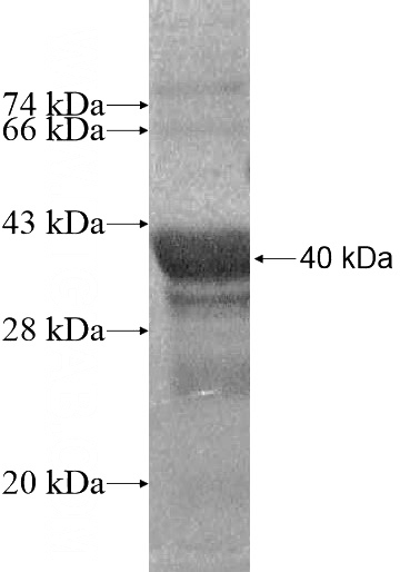 Recombinant Human LYRM1 SDS-PAGE