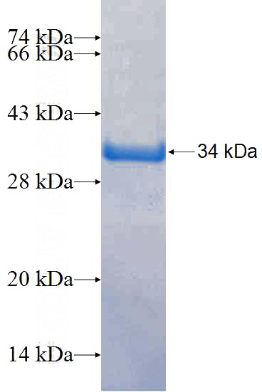 Recombinant Human LIN54 SDS-PAGE