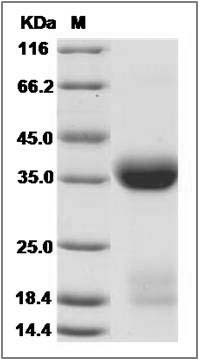 Mouse KLK1 / Kallikrein 1 Protein (His Tag) SDS-PAGE