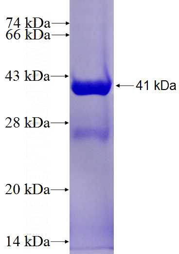 Recombinant Human PSMD8 SDS-PAGE