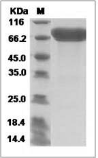 Human NTM / Neurotrimin Protein (Fc Tag) SDS-PAGE