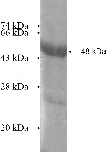 Recombinant Human CTDSPL2 SDS-PAGE