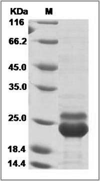 Human K-Ras / K-Ras (12 Asp) Protein (His Tag) SDS-PAGE