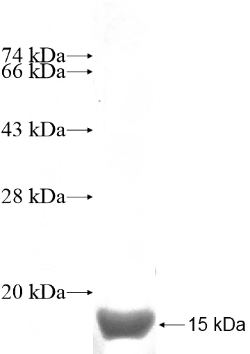 Recombinant Human C9orf16 SDS-PAGE