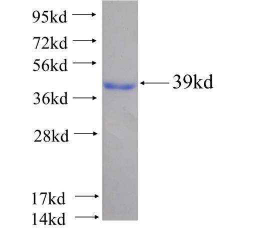 Recombinant human PECI SDS-PAGE