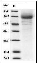 Human CD97 Protein (His Tag) SDS-PAGE
