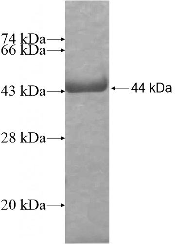 Recombinant Human RALYL SDS-PAGE