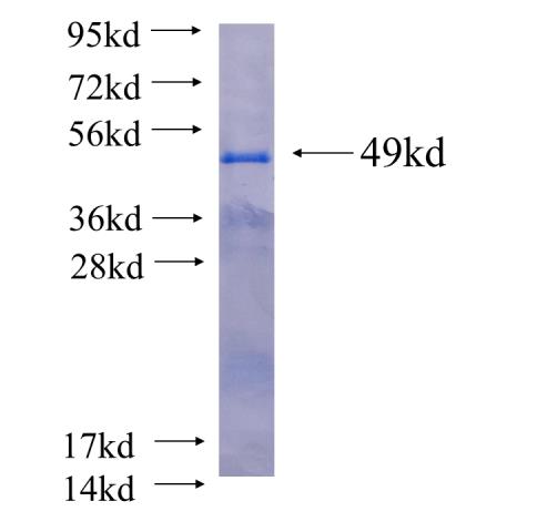 Recombinant human FANCL(Full length) SDS-PAGE